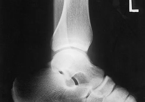 Orthopedic Surgery Board Review 2026 | High-Yield MCQs - Set 5 - Figure 44