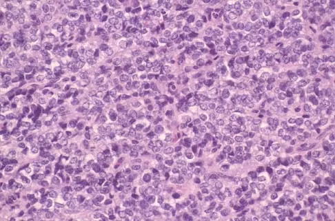 Orthopedic Surgery Board Review 2026 | High-Yield MCQs - Set 5 - Figure 55