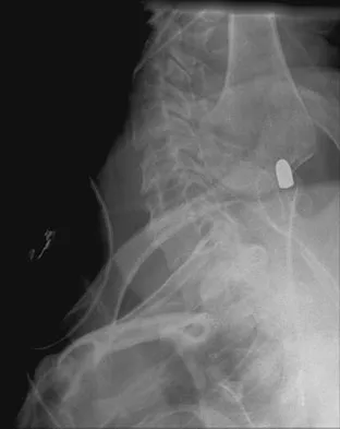 Orthopedic Surgery Board Review 2026 | High-Yield MCQs - Set 5 - Figure 68