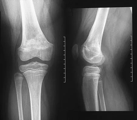 Orthopedic Surgery Board Review 2026 | High-Yield MCQs - Set 5 - Figure 7