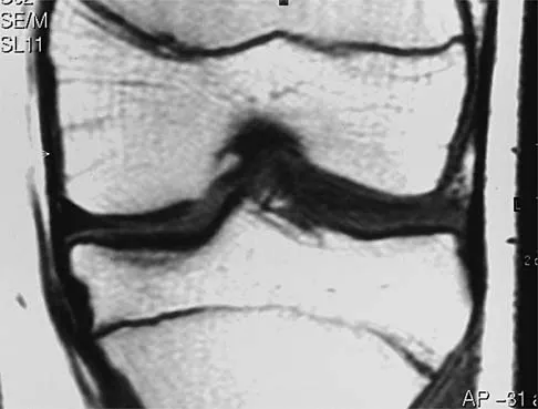 Orthopedic Surgery Board Review 2026 | High-Yield MCQs - Set 5 - Figure 72
