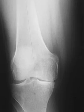 Orthopedic Surgery Board Review 2026 | High-Yield MCQs - Set 5 - Figure 8