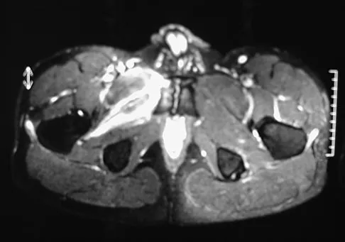 Orthopedic Surgery Board Review 2026 | High-Yield MCQs - Set 5 - Figure 94