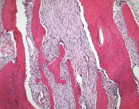 Orthopedic Surgery Board Review 2026 | High-Yield MCQs - Set 6 - Figure 104