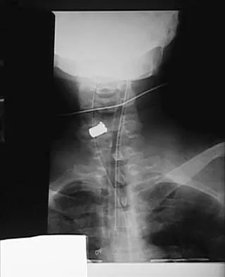 Orthopedic Surgery Board Review 2026 | High-Yield MCQs - Set 6 - Figure 118