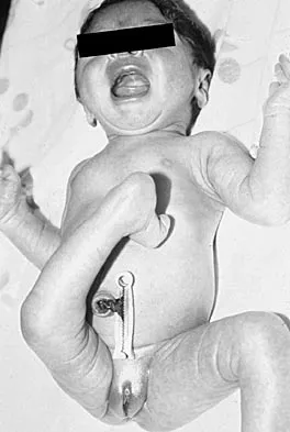 Orthopedic Surgery Board Review 2026 | High-Yield MCQs - Set 6 - Figure 12