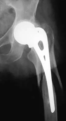 Orthopedic Surgery Board Review 2026 | High-Yield MCQs - Set 6 - Figure 19