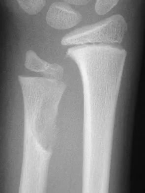 Orthopedic Surgery Board Review 2026 | High-Yield MCQs - Set 6 - Figure 27