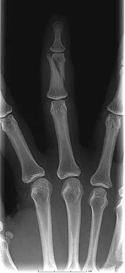 Orthopedic Surgery Board Review 2026 | High-Yield MCQs - Set 6 - Figure 28