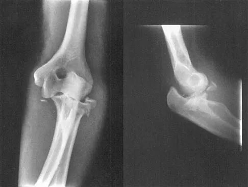 Orthopedic Surgery Board Review 2026 | High-Yield MCQs - Set 6 - Figure 36