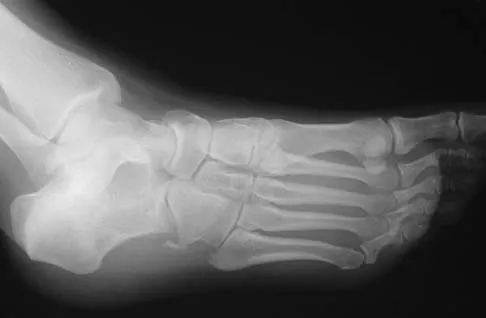 Orthopedic Surgery Board Review 2026 | High-Yield MCQs - Set 6 - Figure 46