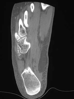 Orthopedic Surgery Board Review 2026 | High-Yield MCQs - Set 6 - Figure 47