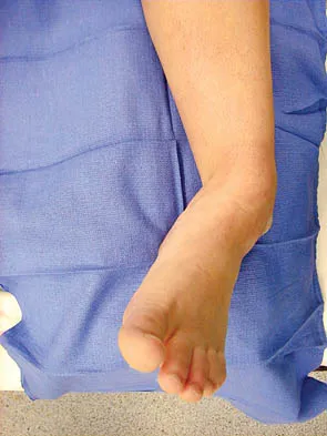 Orthopedic Surgery Board Review 2026 | High-Yield MCQs - Set 6 - Figure 50