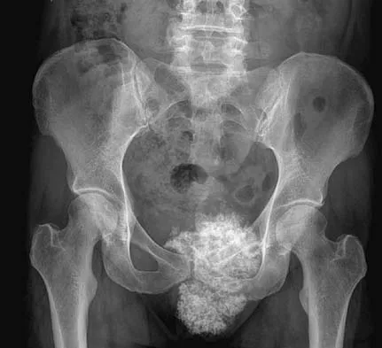 Orthopedic Surgery Board Review 2026 | High-Yield MCQs - Set 6 - Figure 52