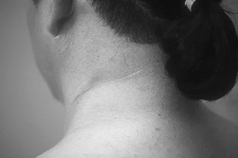 Orthopedic Surgery Board Review 2026 | High-Yield MCQs - Set 6 - Figure 67