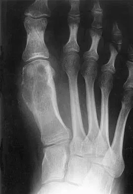 Orthopedic Surgery Board Review 2026 | High-Yield MCQs - Set 6 - Figure 68