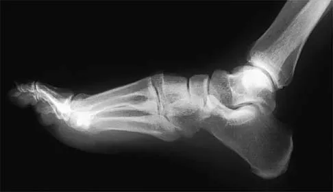 Orthopedic Surgery Board Review 2026 | High-Yield MCQs - Set 6 - Figure 77