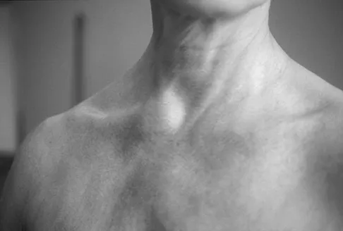 Orthopedic Surgery Board Review 2026 | High-Yield MCQs - Set 6 - Figure 79