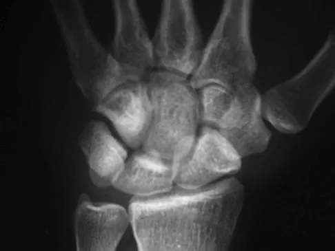 Orthopedic Surgery Board Review 2026 | High-Yield MCQs - Set 6 - Figure 93