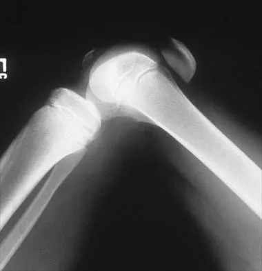 Orthopedic Surgery Board Review 2026 | High-Yield MCQs - Set 7 - Figure 10