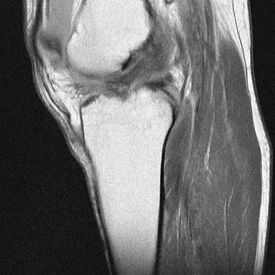 Orthopedic Surgery Board Review 2026 | High-Yield MCQs - Set 7 - Figure 101