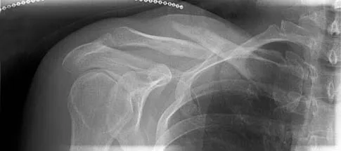 Orthopedic Surgery Board Review 2026 | High-Yield MCQs - Set 7 - Figure 12