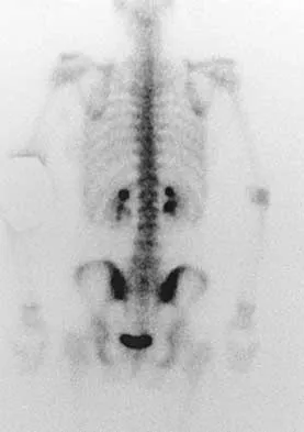 Orthopedic Surgery Board Review 2026 | High-Yield MCQs - Set 7 - Figure 22