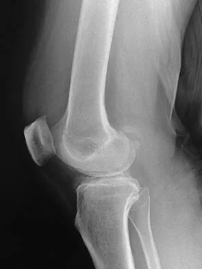 Orthopedic Surgery Board Review 2026 | High-Yield MCQs - Set 7 - Figure 26