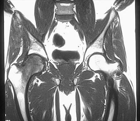 Orthopedic Surgery Board Review 2026 | High-Yield MCQs - Set 7 - Figure 28