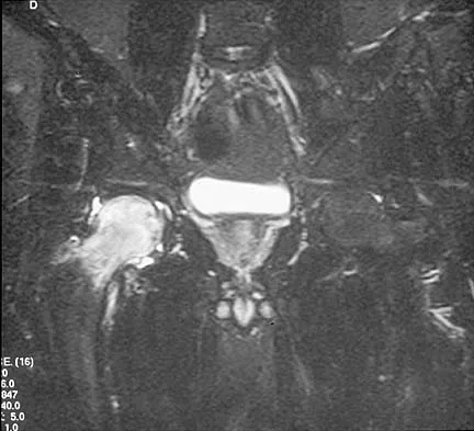 Orthopedic Surgery Board Review 2026 | High-Yield MCQs - Set 7 - Figure 29