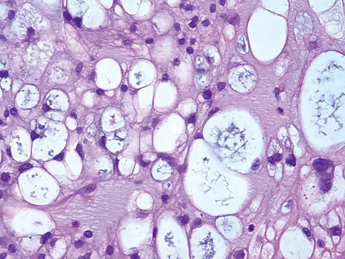 Orthopedic Surgery Board Review 2026 | High-Yield MCQs - Set 7 - Figure 44