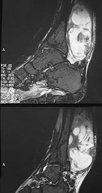 Orthopedic Surgery Board Review 2026 | High-Yield MCQs - Set 7 - Figure 47