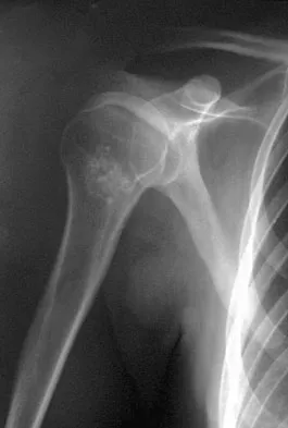 Orthopedic Surgery Board Review 2026 | High-Yield MCQs - Set 7 - Figure 49