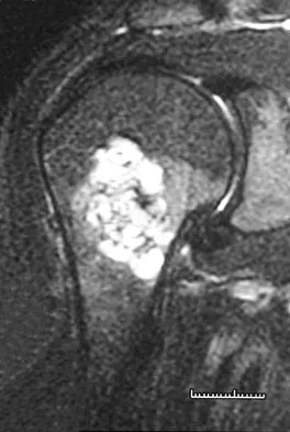 Orthopedic Surgery Board Review 2026 | High-Yield MCQs - Set 7 - Figure 52