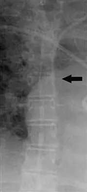 Orthopedic Surgery Board Review 2026 | High-Yield MCQs - Set 7 - Figure 54