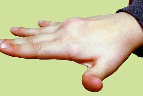 Orthopedic Surgery Board Review 2026 | High-Yield MCQs - Set 7 - Figure 7