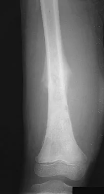 Orthopedic Surgery Board Review 2026 | High-Yield MCQs - Set 7 - Figure 71