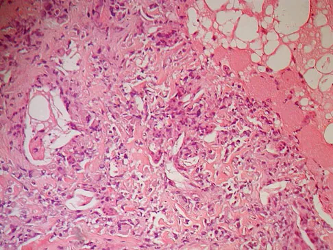 Orthopedic Surgery Board Review 2026 | High-Yield MCQs - Set 7 - Figure 73