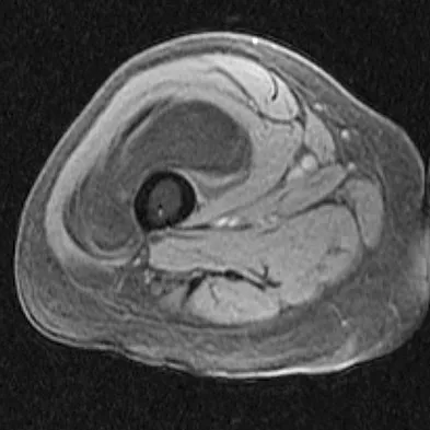 Orthopedic Surgery Board Review 2026 | High-Yield MCQs - Set 7 - Figure 81