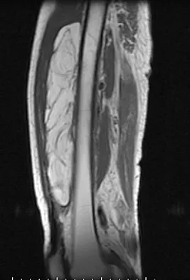 Orthopedic Surgery Board Review 2026 | High-Yield MCQs - Set 7 - Figure 83