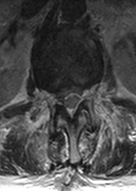 Orthopedic Surgery Board Review 2026 | High-Yield MCQs - Set 7 - Figure 89
