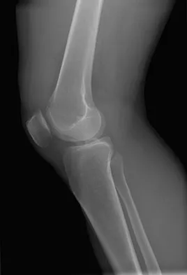 Orthopedic Surgery Board Review 2026 | High-Yield MCQs - Set 7 - Figure 99