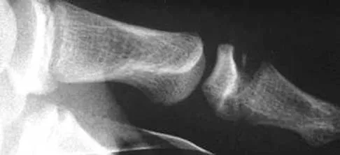 Orthopedic Surgery Board Review 2026 | High-Yield MCQs - Set 8 - Figure 11