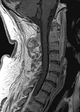 Orthopedic Surgery Board Review 2026 | High-Yield MCQs - Set 8 - Figure 16