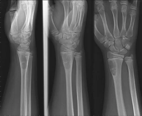 Orthopedic Surgery Board Review 2026 | High-Yield MCQs - Set 8 - Figure 36