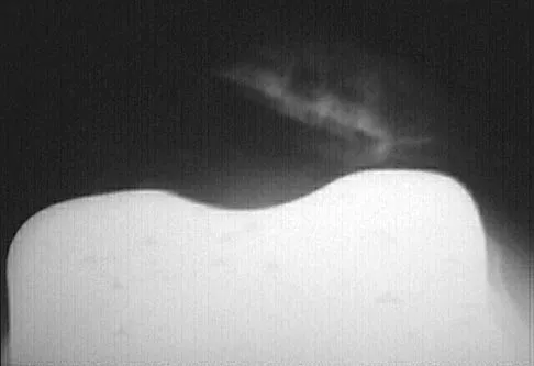 Orthopedic Surgery Board Review 2026 | High-Yield MCQs - Set 8 - Figure 4