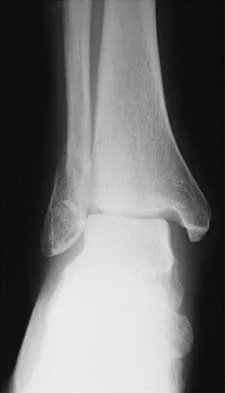 Orthopedic Surgery Board Review 2026 | High-Yield MCQs - Set 8 - Figure 41