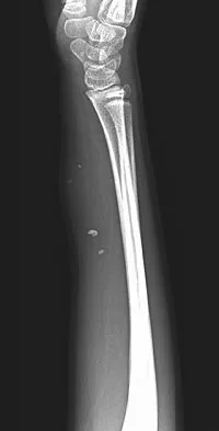 Orthopedic Surgery Board Review 2026 | High-Yield MCQs - Set 8 - Figure 44