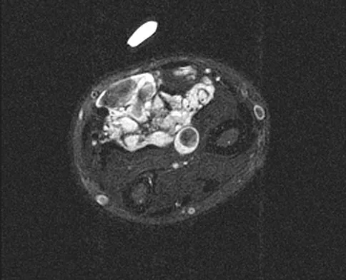 Orthopedic Surgery Board Review 2026 | High-Yield MCQs - Set 8 - Figure 45