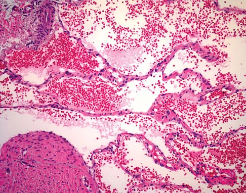 Orthopedic Surgery Board Review 2026 | High-Yield MCQs - Set 8 - Figure 46